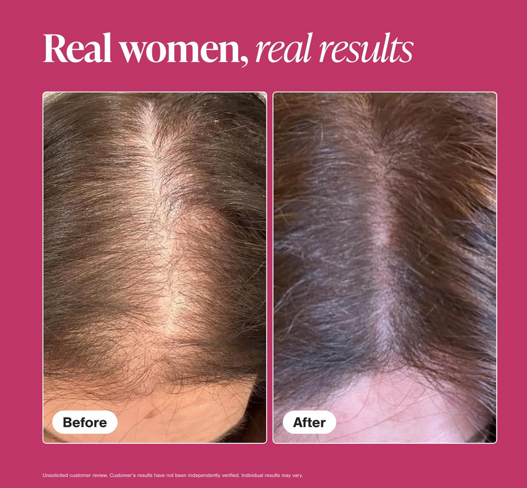 Viviscal Hair Growth Supplements for Women – Pack of 2, 120 Tablets