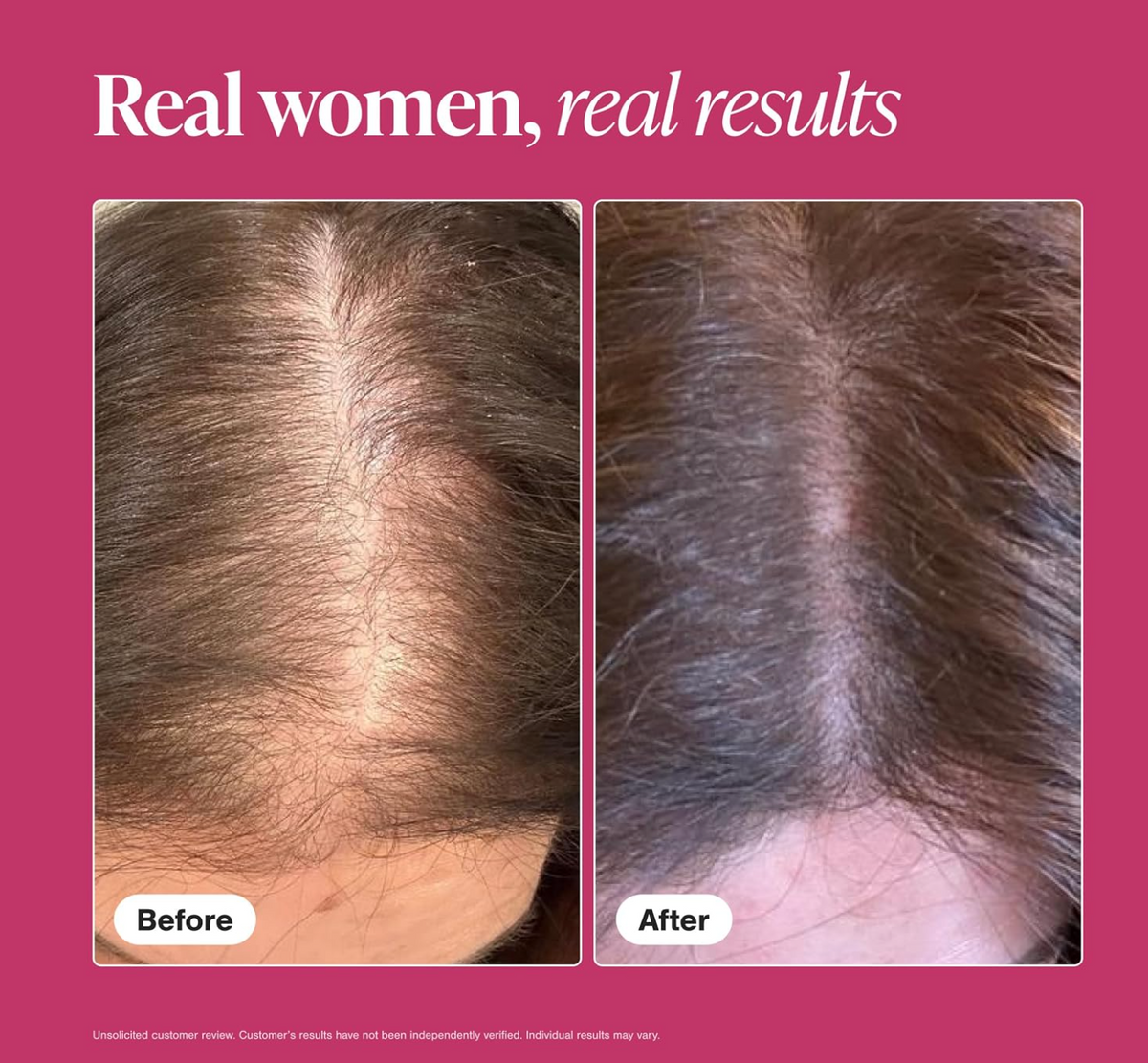 Viviscal Hair Growth Supplements for Women – Pack of 2, 120 Tablets